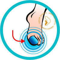 Gel Toe Cap